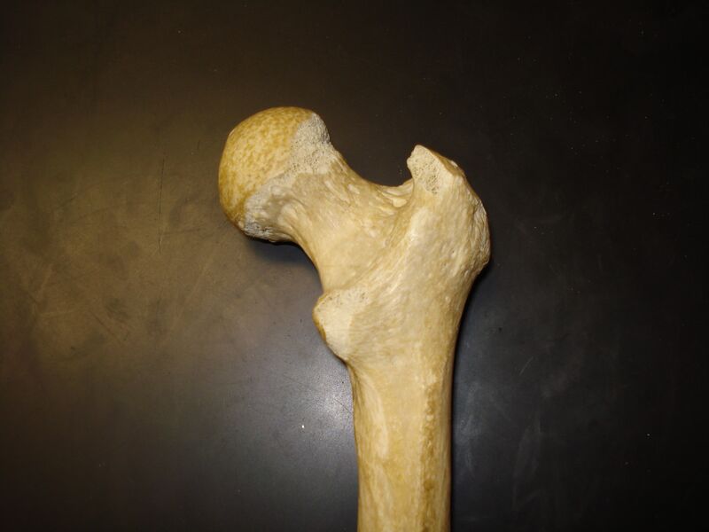 Datei:Menschlicher Knochen.jpg